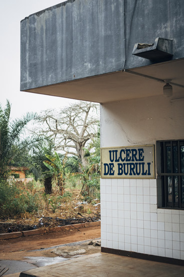 La unidad de úlcera de Buruli del Hospital Regional de Tsévié, financiada por Fundación Anesvad.