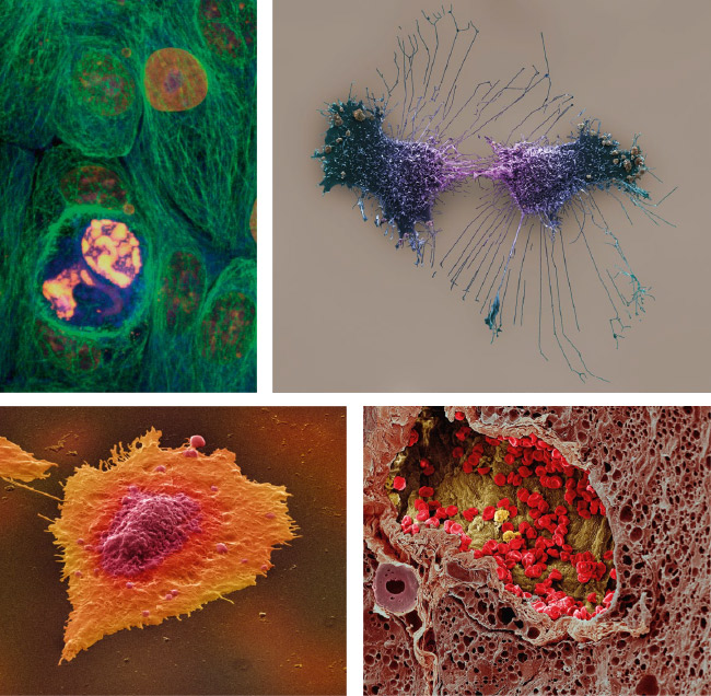 De izquierda a derecha, células de cáncer de pecho, células HeLa, células de cáncer de colón y vasos sanguíneos en un melanoma